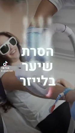 הסרת שיער בלייזר
